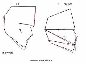 プロフィログラム