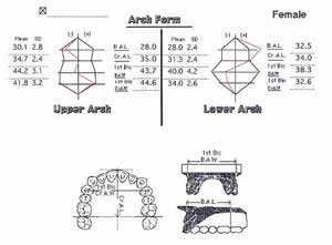 歯列弓の長径と幅径の計測