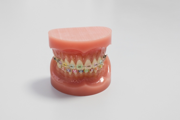 歯並びに良くない癖（習慣）への注意事項