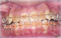 カラーモジュール