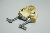 リンガルアーチ